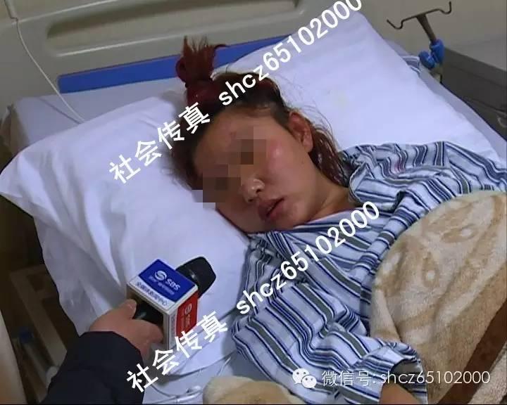 仁果类水果 第76页